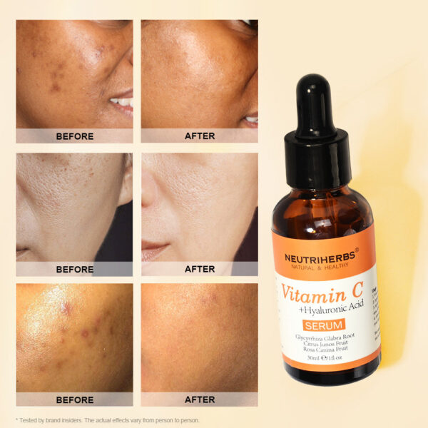 Vitamin C Serum